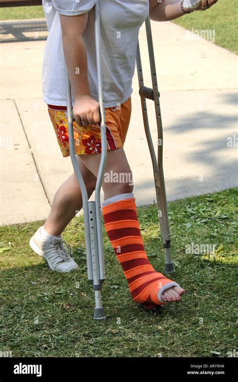 Teenage Female With A Broken Ankle Walking On Crutches Stock Photo Alamy