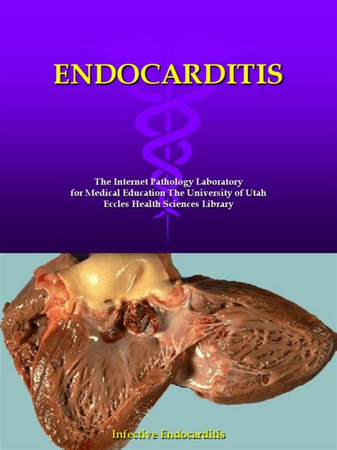 Endocarditis Heart Valve Internal Medicine Free 30 Day Trial Scribd