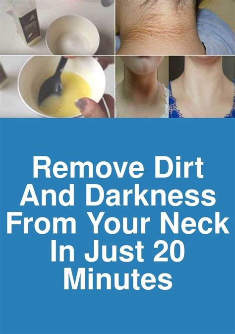 Remove Dirt And Darkness From Your Neck In Just 20 Minutes Since The