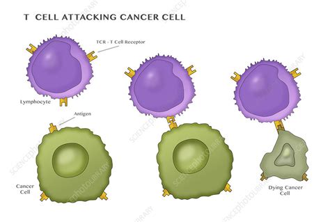 T Cell Attacking Cancer Cell Stock Image C0365698 Science Photo