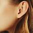 Pixie Ear Correction  Bella Vou Face Treatments & Cosmetic Surgery