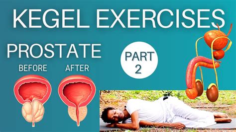 Kegel Exercises For Enlarged Prostate Part Pelvic Floor Strengthenin Kegel Exercise