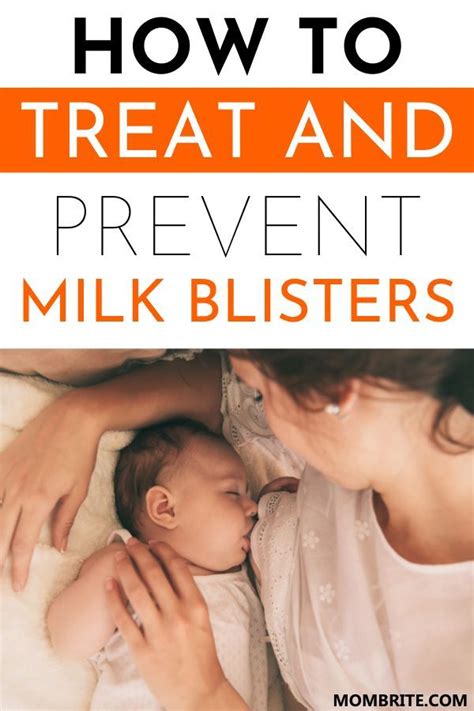 how to treat and prevent milk blisters mombrite in 2020 milk blister breastfeeding