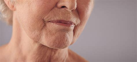 How To Reduce Neck Wrinkles Without Surgery