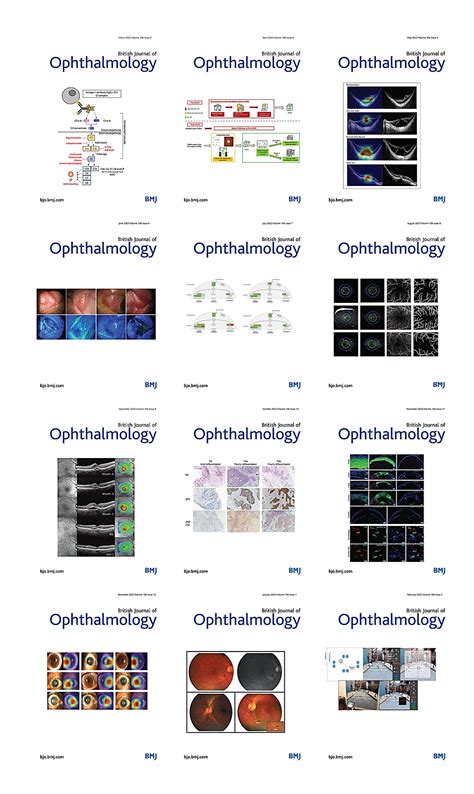 British Journal Of Ophthalmology 2022 Full Archives Ophthalmology Library