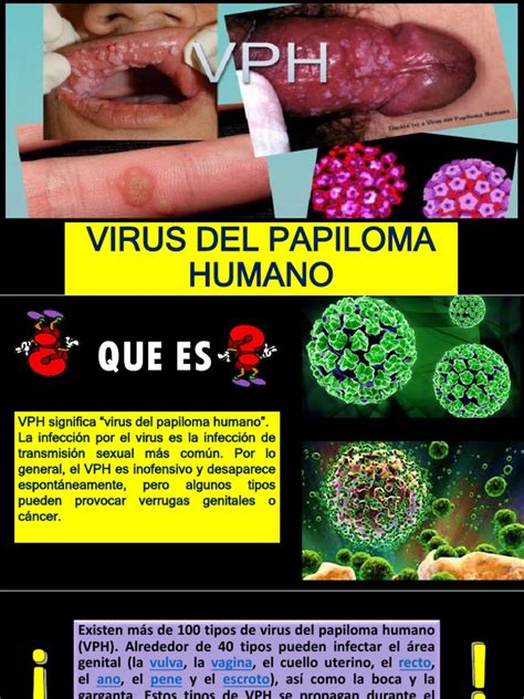 Virus Del Papiloma Humanopptx