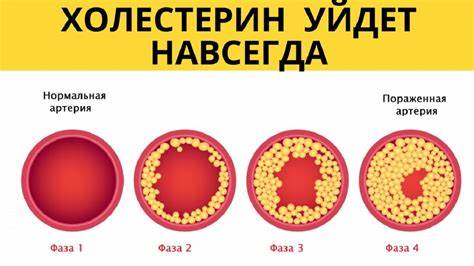 Диета холестериновая 10 Продукты снижающие холестерин. Холестериновая диета - YouTube Продукты снижающие холестерин. Холестериновая диета - YouTube Диета холестериновая 10