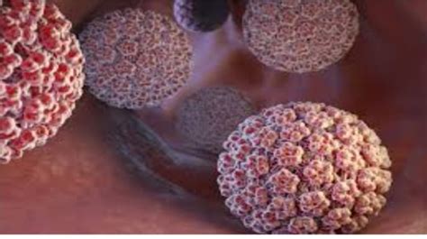 Understanding Genital Warts Symptoms And Treatment Options World Today News