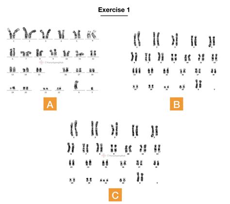 Best Karyotyping Activities And Assignments Karyotypinghub