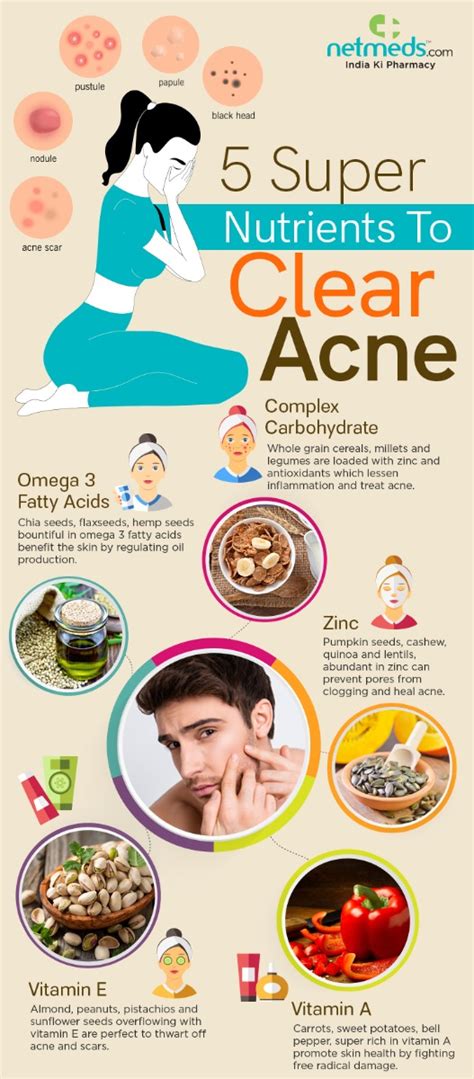 Anti Acne Food Eat Healthy To Heal Acne Infographic