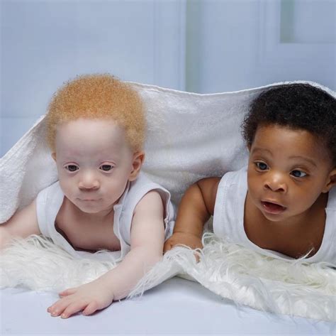 Mom Brings Into The World Black And White Twins And People Often Think