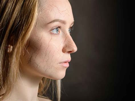 Dry Skin Patches Causes And Symptoms Taiz Mind