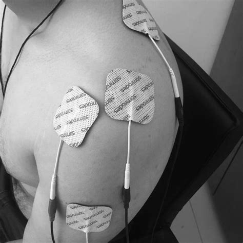 Application Of The Nmes And Electrode Pad Placement Locations