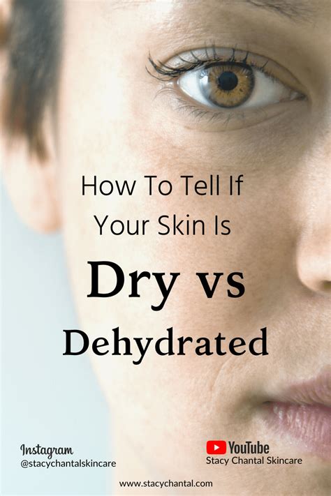 How To Tell If You Have Dry Vs Dehydrated Skin Stacy Chantal Skincare