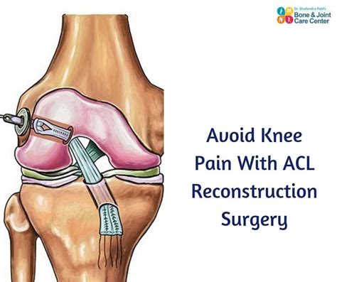 Meet Dr Shailendra Patil Who The Best Doctor For Acl Surgery In Kalyan