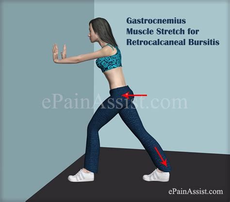 Gastrocnemius Muscle Stretch For Retrocalcaneal Bursitis Or Achilles