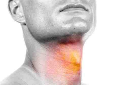 Over time, there will be bleeding from the the tumour or cancerous lump expands in size and swells in the throat. Growth In Throat Near Thyroid Sore Roof Sinusitis Mouth ...