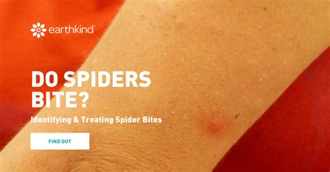 Common House Spider Bites Identification And When To Worry