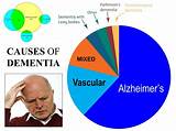 Dementia caused by Parkinson's disease - Alzheimer's disease: Causes ...
