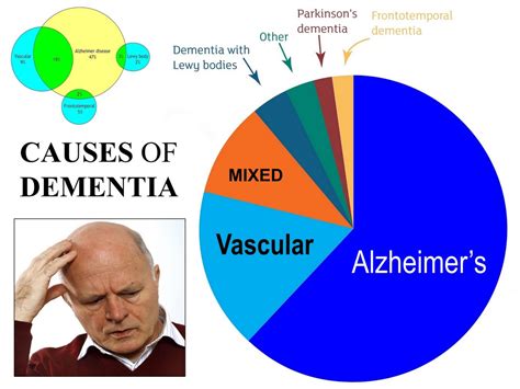 Tremors are common, but the disorder. Dementia caused by Parkinson's disease - Alzheimer's ...