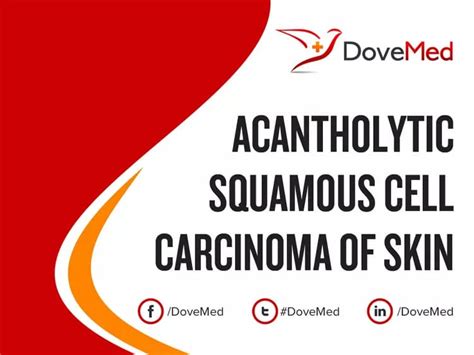 Acantholytic Squamous Cell Carcinoma Of Skin Dovemed