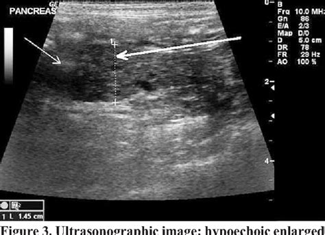 Figure 1 From Acute Pancreatitis In Dogs And Cats Medical Imaging