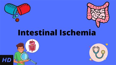 Intestinal Ischemia Causes Signs And Symptoms Diagnosis And