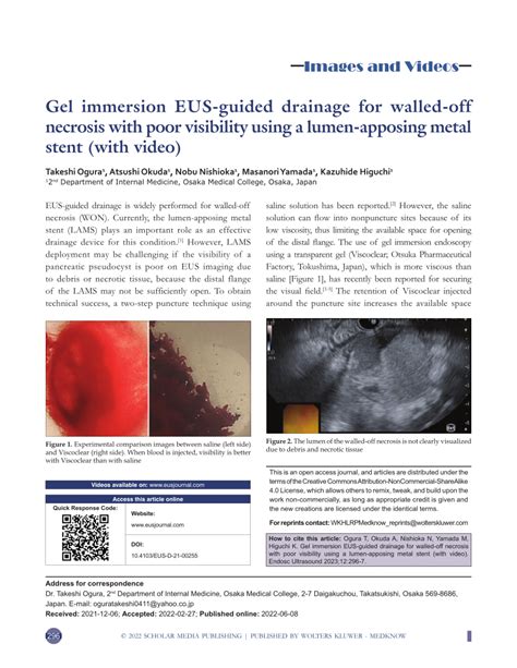 Pdf Gel Immersion Eus Guided Drainage For Walled Off Necrosis With