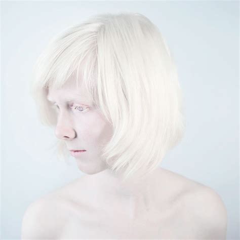 Sanne De Wilde Snow White Albino Model Portrait Albinism