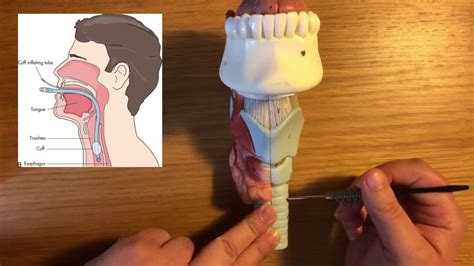 Laryngeal Anatomy Part 1 External Features Of Larynx And Applications To