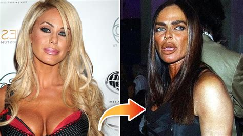 10 Worst Celebrity Plastic Surgery Disasters Youtube