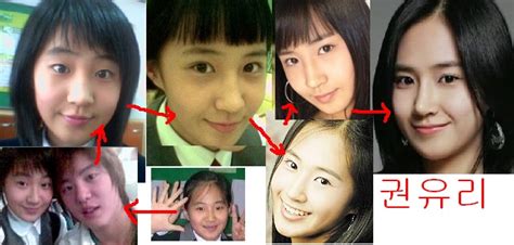 Plastic Surgery Examples Girls Generation Snsd Yuri Plastic Surgery Before And After 少女時代 소녀시대 유리