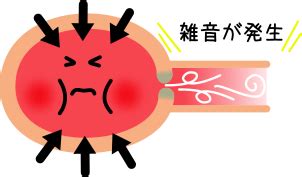 抖音 心如止水 yusee 女聲版 動態歌詞lyrics. 大動脈弁狭窄症（AS)
