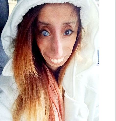 Meet 25 Year Old Lizzie Velasquez Who Was Once Taggedworlds Ugliest