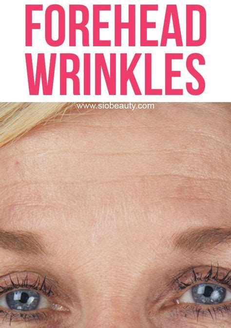 Treatment For Forehead Wrinkles The 10 Best Options Forehead Wrinkle