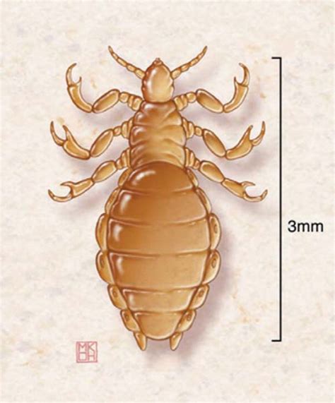 Lice And Scabies Treatment Update Aafp