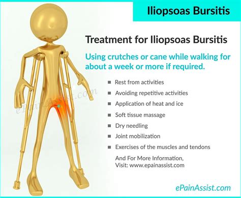 Iliopsoas Bursitis Or Iliopectineal Bursitis Hip Bursitis Exercises