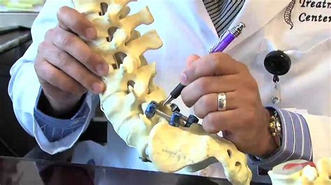 Surgical Procedures Lumbar Laminectomy And Discectomy Youtube