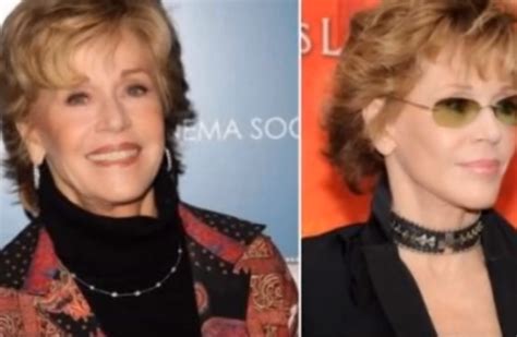 Jane Fonda Plastic Surgery 3 - Plastic Surgery Log