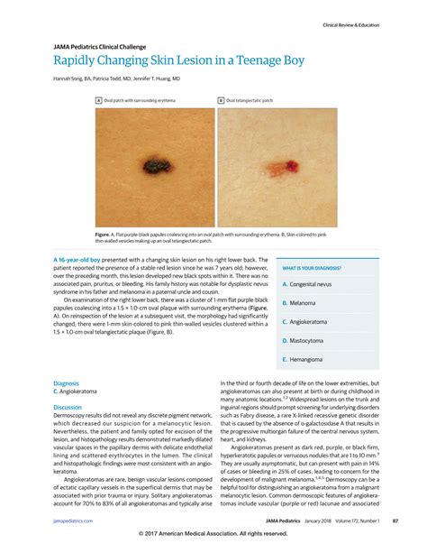 Rapidly Changing Skin Lesion In A Teenage Boy Adolescent Medicine