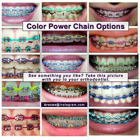 Color Power Chains Braces Tips Cute Braces Colors Cute Braces