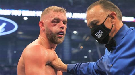Billy Joe Saunders Boxing Career Appears To Be Over