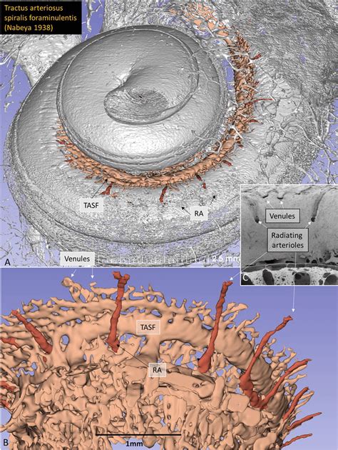 A Base Of The Cochlea Shown In Higher Magnification The