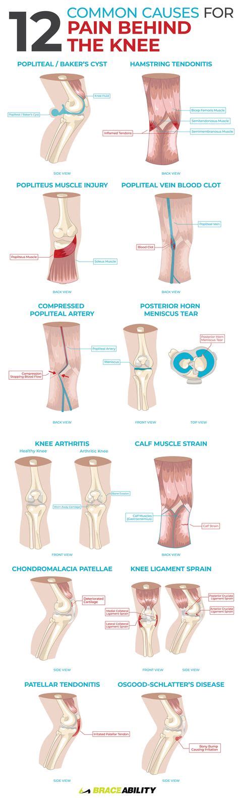 Pin On Knee Pain