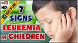 Therefore, to have an accurate diagnosis of leukemia, certain criteria. 7 Symptoms of Leukemia in Children | Signs of Leukemia ...