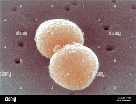 Micrografía Electrónica De Streptococcus Pneumoniae Fotografía De Stock