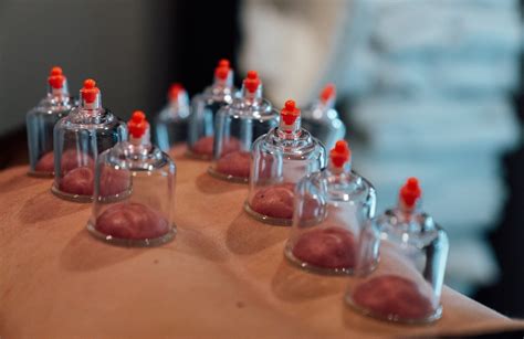 The Benefits Of Cupping Depth Training Physiotherapy