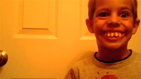 Little Kid With Bad Teeth Youtube