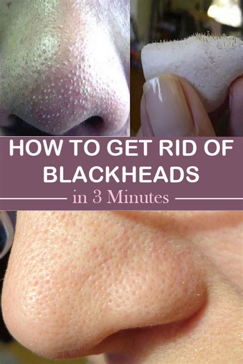 Beauty Enhancers How To Get Rid Of Blackheads In 3 Minutes