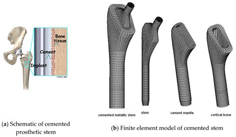 Applied Sciences Free Full Text Biomechanical Performance Of The